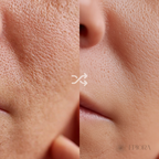 Niacinamida Serum 10®