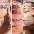 Niacinamida Serum 10®